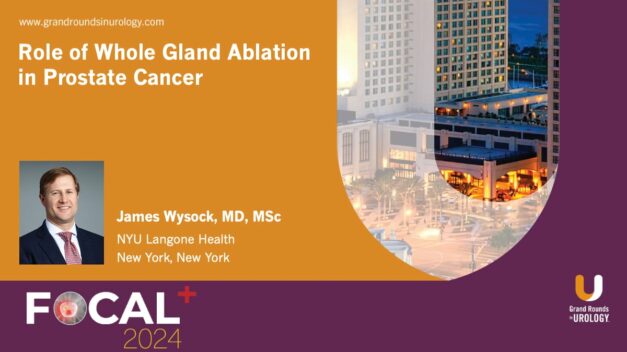 Role of Whole Gland Ablation in Prostate Cancer