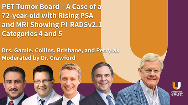 Protected: PET Tumor Board – Case 2: A Case of a 72-year-old with Rising PSA and MRI Showing PI-RADSv2.1 Categories 4 and 5