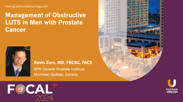 Management of Obstructive LUTS in Men with Prostate Cancer