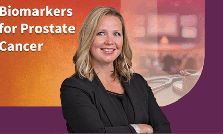 Biomarkers for Prostate Cancer