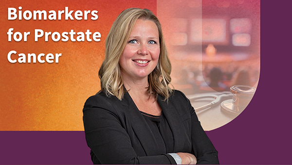 Biomarkers for Prostate Cancer