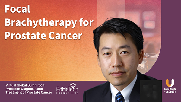 Focal Brachytherapy for Prostate Cancer