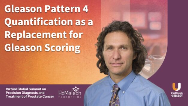 Gleason Pattern 4 Quantification as a Replacement for Gleason Scoring