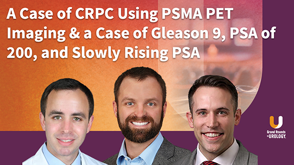 A Case of CRPC Using PSMA PET Imaging & a Case of Gleason 9, PSA of 200, and Slowly Rising PSA
