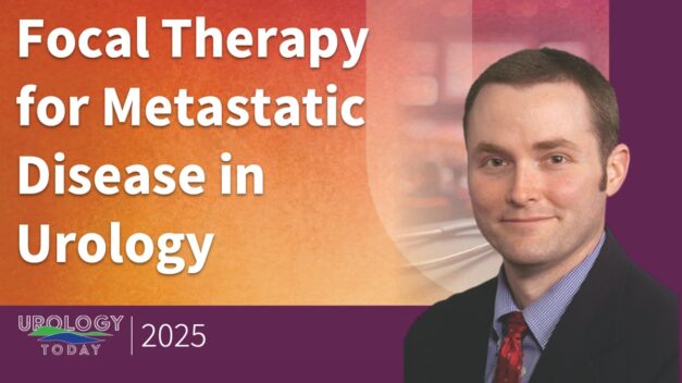 Focal Therapy for Metastatic Disease in Prostate Cancer