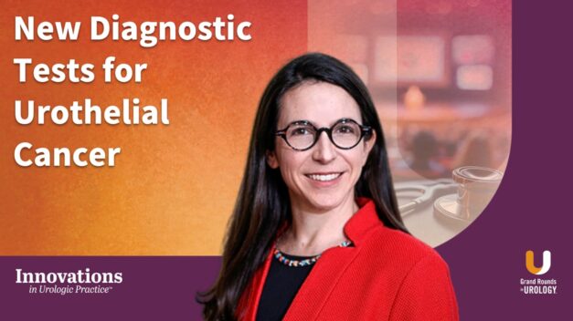 New Diagnostic Tests for Urothelial Cancer