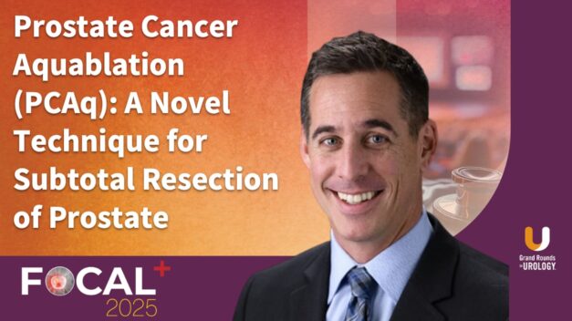 Prostate Cancer Aquablation (PCAq): A Novel Technique for Subtotal Resection of Prostate