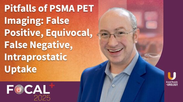 Pitfalls of PSMA PET Imaging: False Positive, Equivocal, False Negative, Intraprostatic Uptake