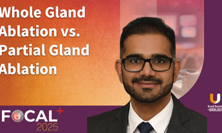 Whole Gland Ablation vs. Partial Gland Ablation