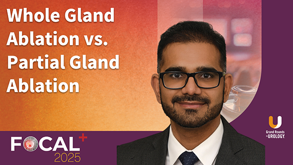 Whole Gland Ablation vs. Partial Gland Ablation