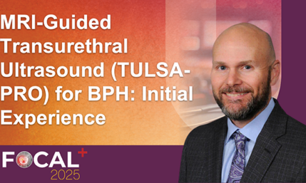 MRI-Guided Transurethral Ultrasound (TULSA-PRO) for BPH: Initial Experience