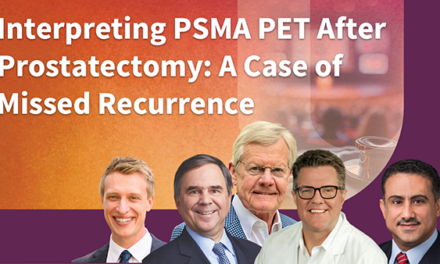 Interpreting PSMA PET After Prostatectomy: A Case of Missed Recurrence