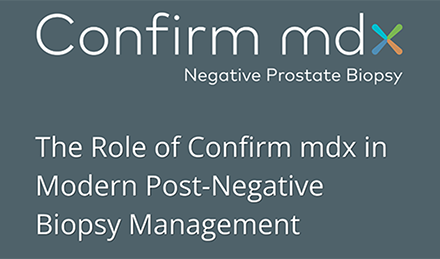 Proven Science, Evolving Practice: The Role of Confirm mdx in Modern Post-Negative Biopsy Management